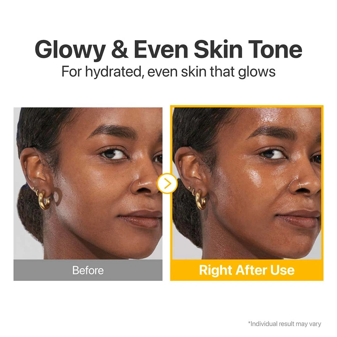 Before and after comparison of a woman's face with text indicating improved skin tone.