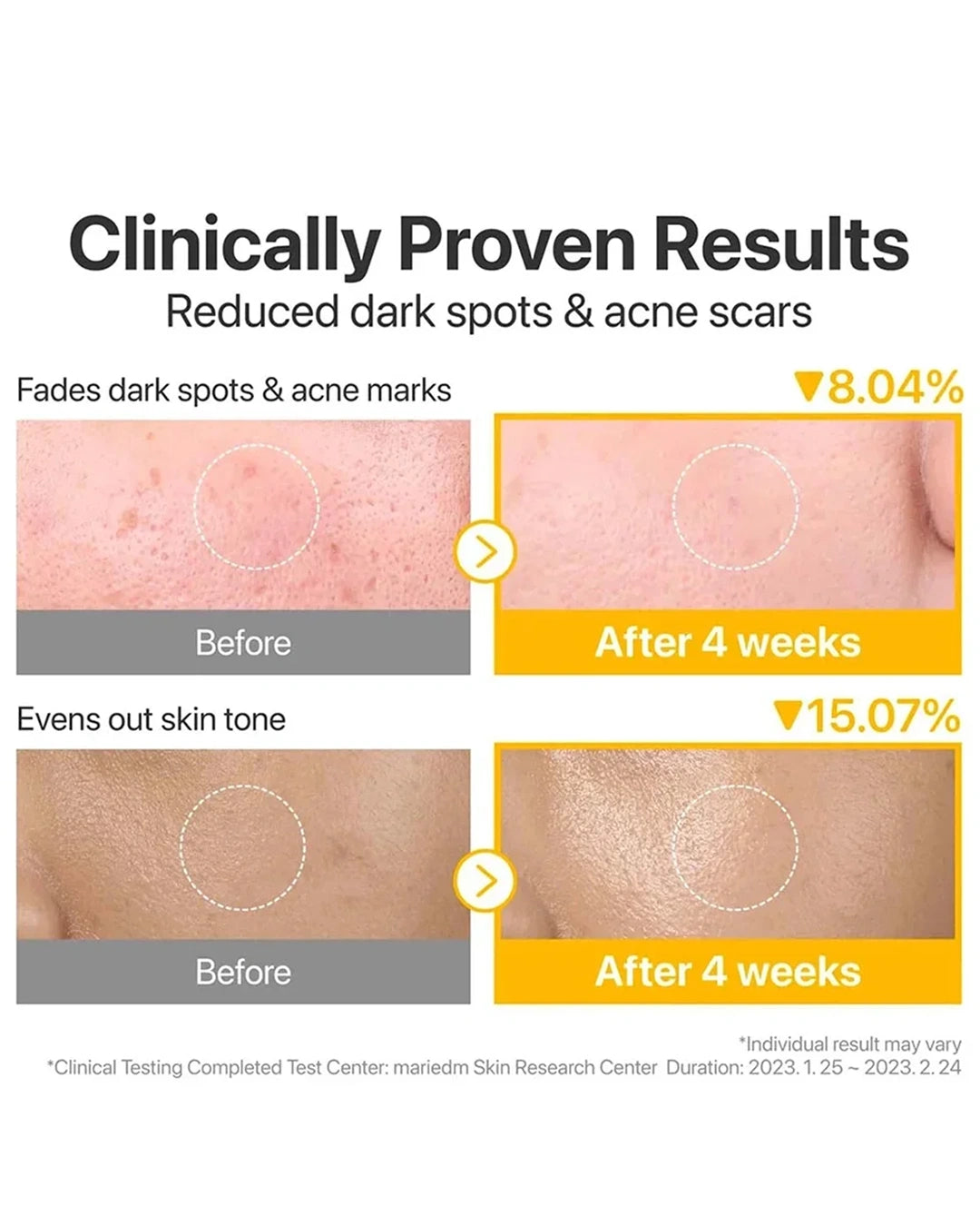 Before-and-after skin results infographic showing reduced dark spots and acne scars after 4 weeks, with close-up skin photos and percentage improvements.
