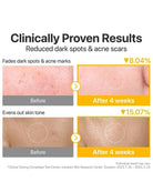 Before-and-after skin results infographic showing reduced dark spots and acne scars after 4 weeks, with close-up skin photos and percentage improvements.