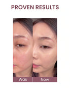 Before-and-after comparison of a woman's face showing skin improvement, with the text 'PROVEN RESULTS' at the top and 'Was' and 'Now' labels at the bottom.