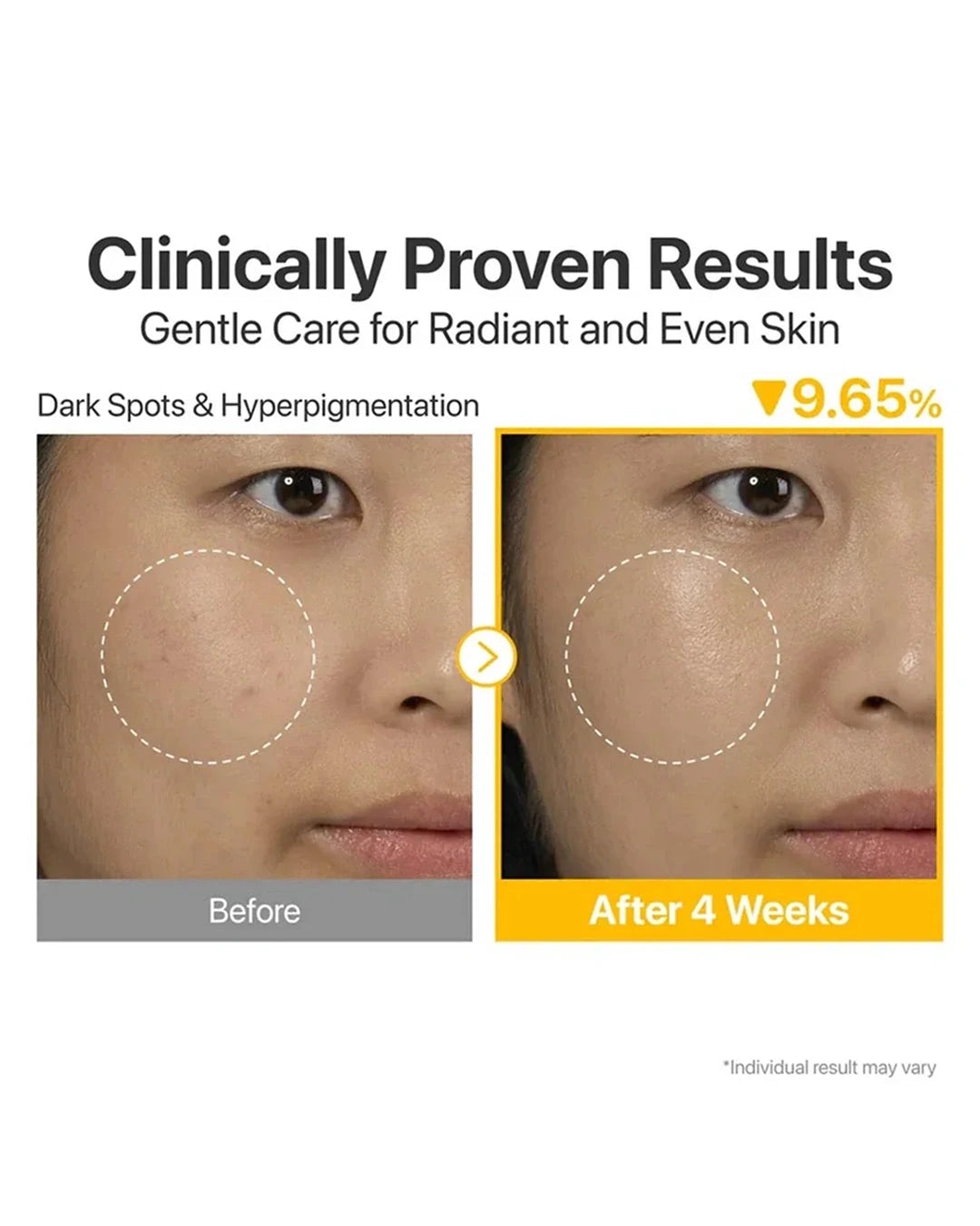 Before-and-after skin comparison graphic showing a woman's cheek with visible blemishes in the 'Before' panel and clearer skin in the 'After 4 Weeks' panel, with text reading 'Clinically Proven Results' and 'Dark Spots & Hyperpigmentation'.