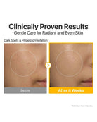 Before-and-after skin comparison graphic showing a close-up of a cheek with dark spots and hyperpigmentation, labeled 'Before' on the left and 'After 4 Weeks' on the right, with the headline 'Clinically Proven Results' above.