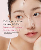 Close-up beauty ad showing a woman's face with text reading 'Daily toner suitable for troubled skin' and 'Non-comedogenic test completed' on a soft pink background.
