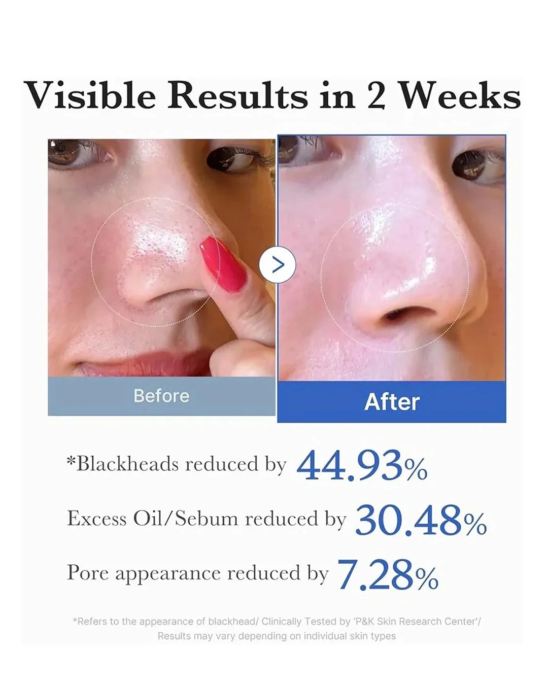 Before-and-after comparison graphic showing a person's nose with a highlighted blackhead on the left and a clearer, smoother nose on the right, with text claiming visible results in 2 weeks and percentage reductions for blackheads, excess oil, and pore appearance.