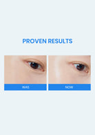 Before and after comparison of a person's eye with 'Proven Results' text above.