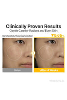 Before and after comparison of dark spots and hyperpigmentation treatment with text 'Clinically Proven Results' on a white background.