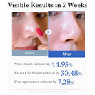 Before and after comparison of skin treatment with visible results in 2 weeks.